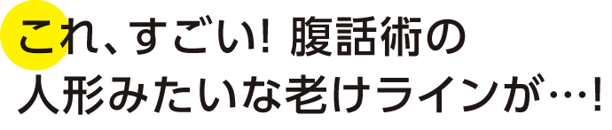 これ、すごい! 腹話術の人形みたいな老けラインが…!